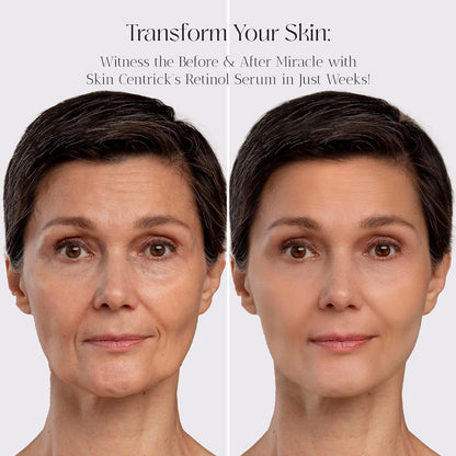 Retinol Serum image 3