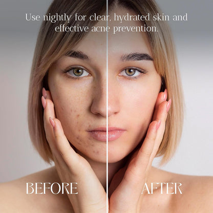 Acne Night Cream image 3