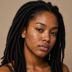 Acne-prone skin image