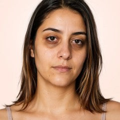 Dark circle image