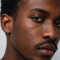 Enlarged pores concern image