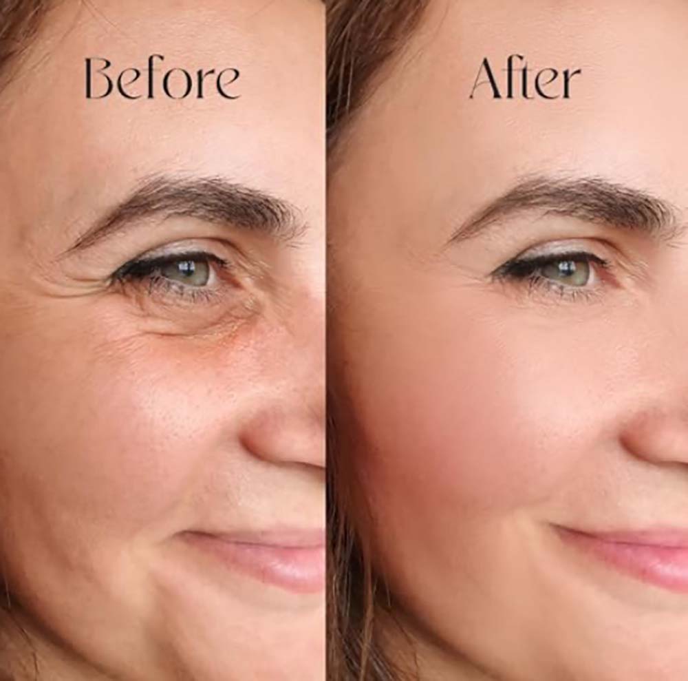 Hyaluronic Acid Serum image 1