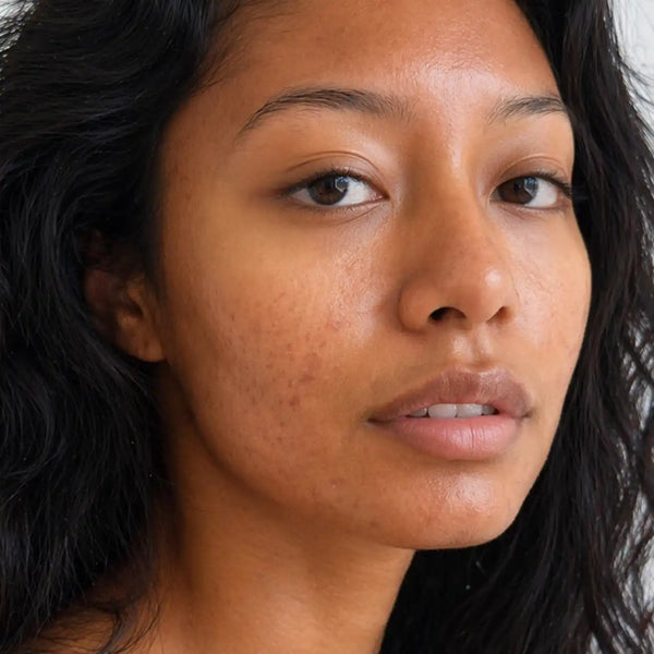Skin repair concern image